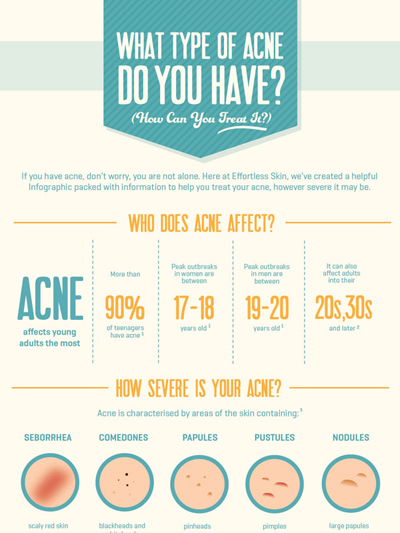 What Type of Acne Do You Have and How Can You Treat It?